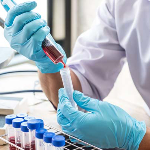 Gloved hands transferring a blood sample beside a rack of test tubes