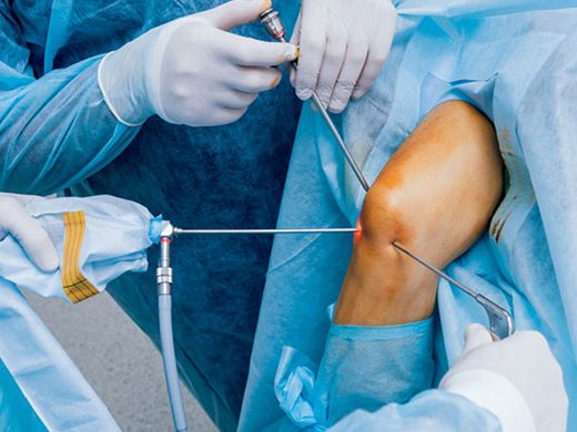 Arthroscopic knee procedure at Bluebell Hospital